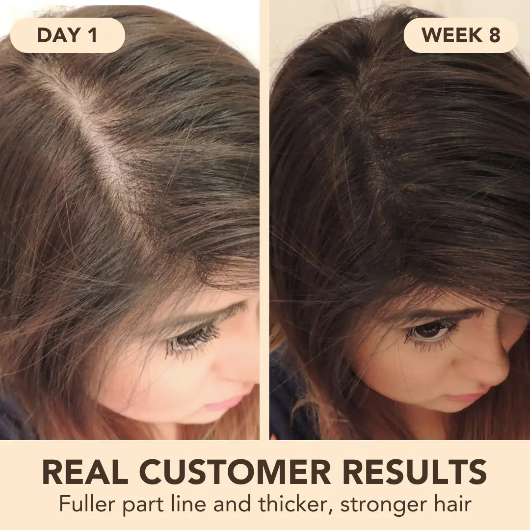 Miracle Growth Oil