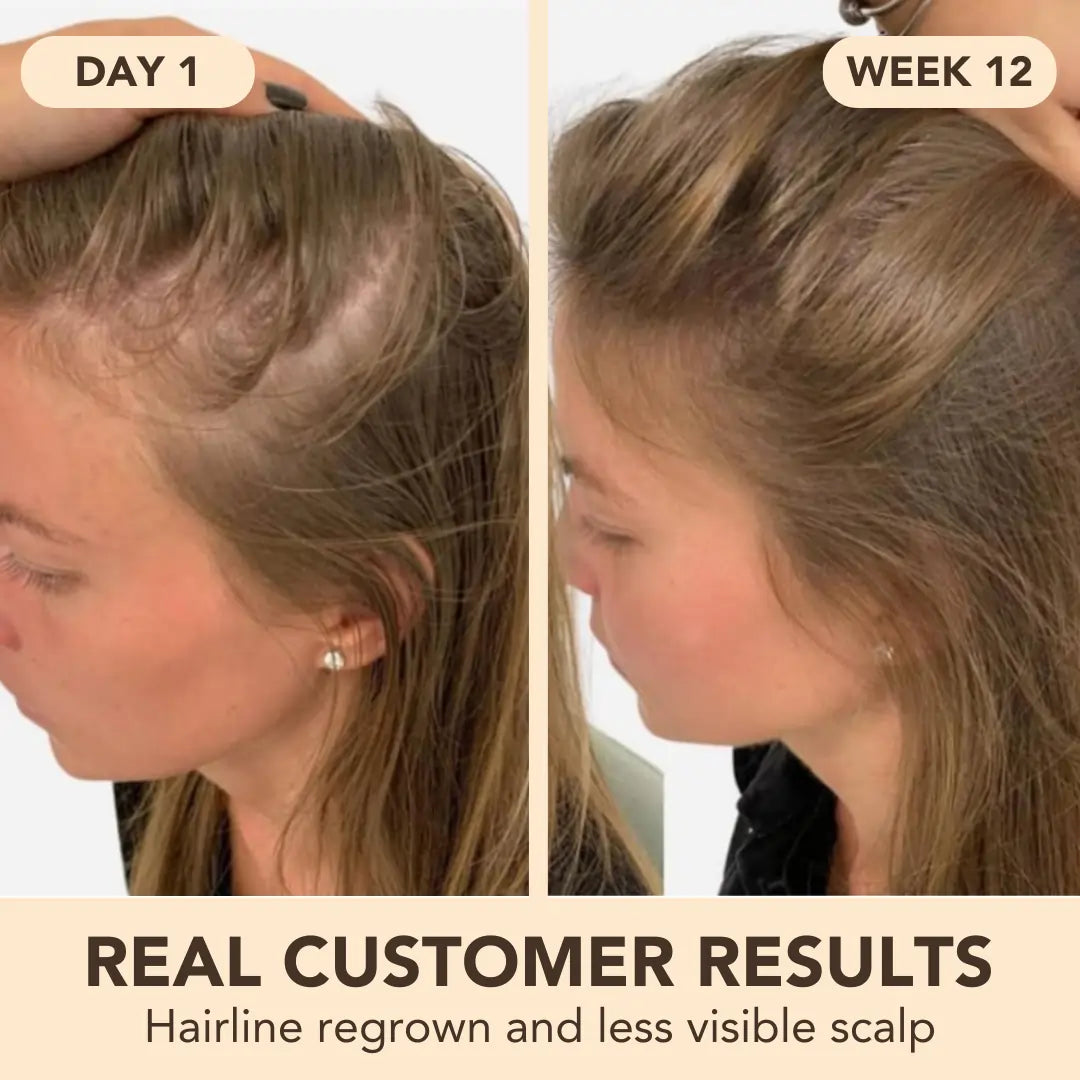 Miracle Growth Oil