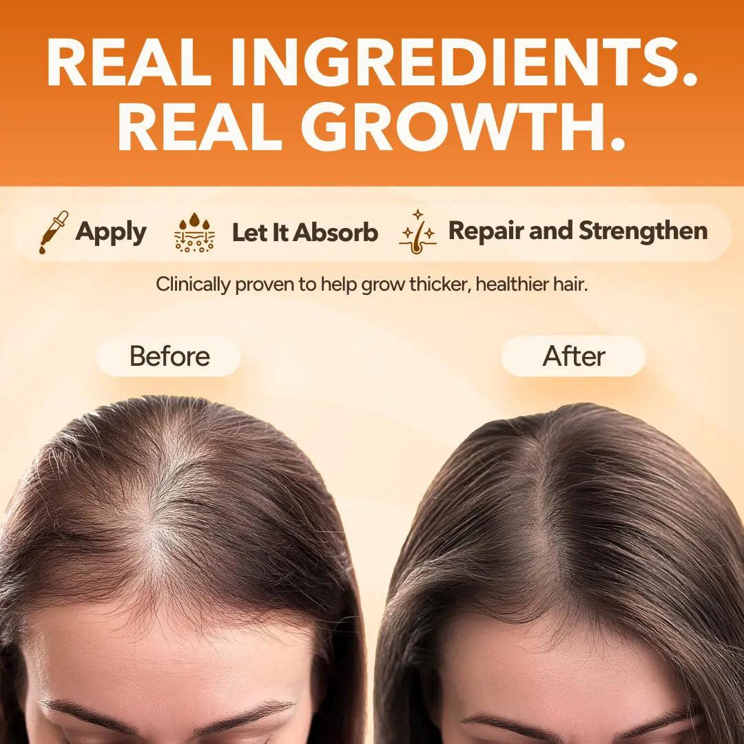 Miracle Growth Oil
