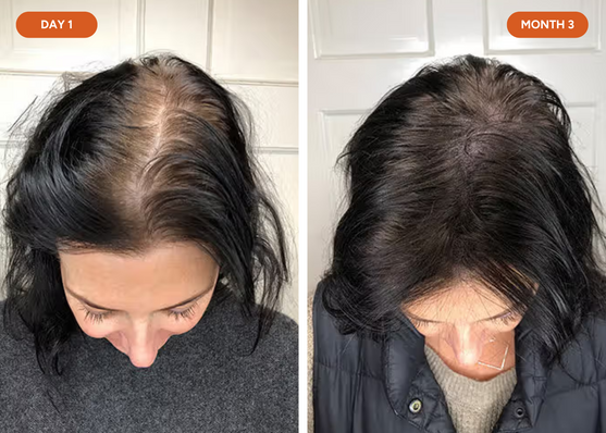Andrea L. hair results