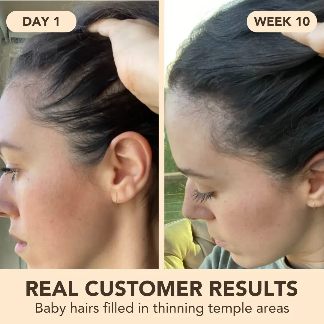 Miracle Growth Oil