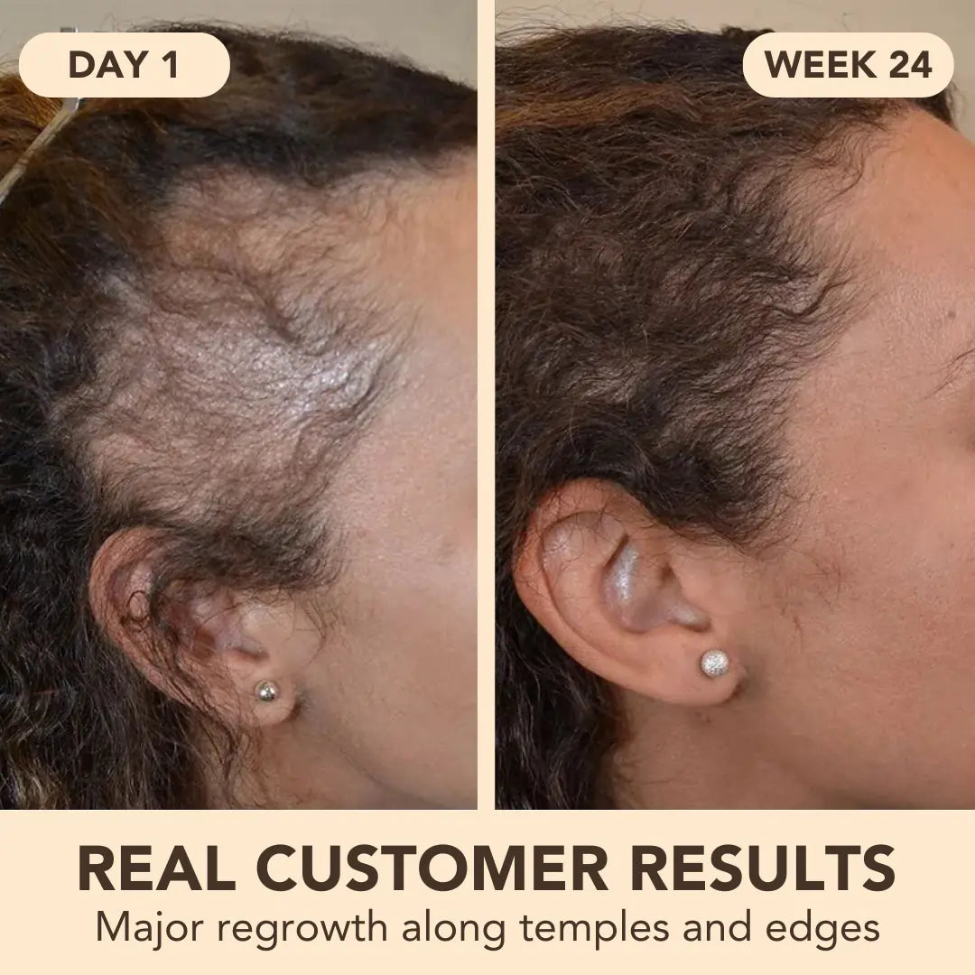 Miracle Growth Oil