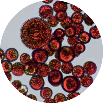 Antioxidant Defence