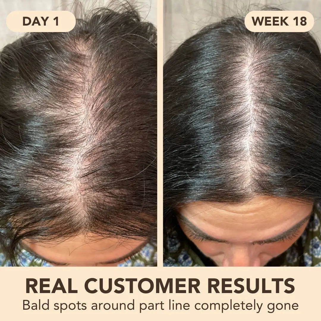 Hair Growth Softgels