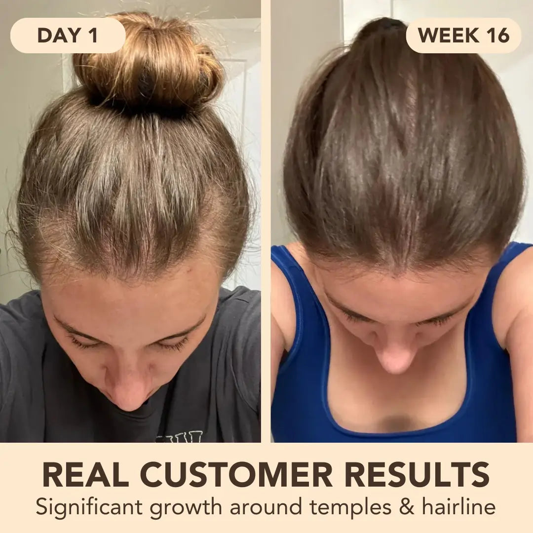 Hair Growth Softgels