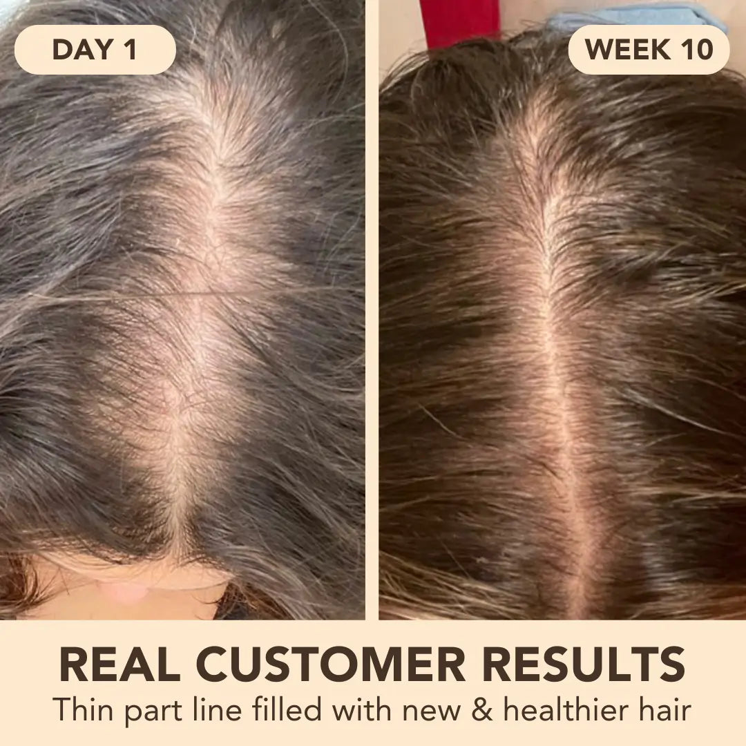 Hair Growth Softgels