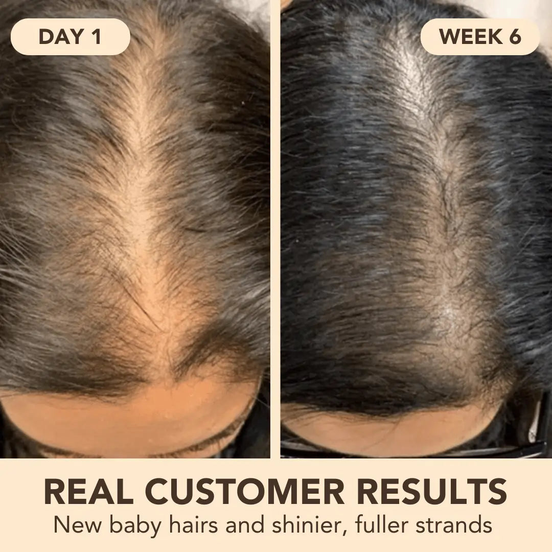 Hair Growth Softgels