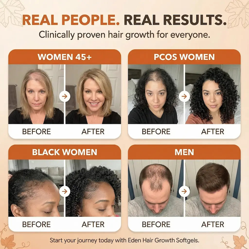 Hair Growth Softgels